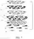 Fig. 09 - Screen Printed Electrodes For An Electrocardiogram Article