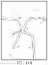 Fig. 16 - Screen Printed Electrodes For An Electrocardiogram Article