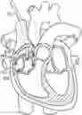 Fig. 01 - CATHETER SYSTEMS AND RELATED METHODS FOR MAPPING, MINIMIZING, AND TREATING CARDIAC FIBRILLATION