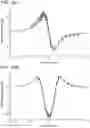 Fig. 23 - CATHETER SYSTEMS AND RELATED METHODS FOR MAPPING, MINIMIZING, AND TREATING CARDIAC FIBRILLATION