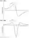 Fig. 24 - CATHETER SYSTEMS AND RELATED METHODS FOR MAPPING, MINIMIZING, AND TREATING CARDIAC FIBRILLATION