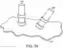 Fig. 35 - CATHETER SYSTEMS AND RELATED METHODS FOR MAPPING, MINIMIZING, AND TREATING CARDIAC FIBRILLATION
