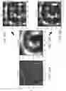 Fig. 38 - CATHETER SYSTEMS AND RELATED METHODS FOR MAPPING, MINIMIZING, AND TREATING CARDIAC FIBRILLATION