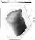 Fig. 60 - CATHETER SYSTEMS AND RELATED METHODS FOR MAPPING, MINIMIZING, AND TREATING CARDIAC FIBRILLATION