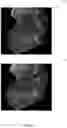 Fig. 08 - SIGNAL PROCESSING OF VELOCITY STREAMS OF A SIGNAL FLOW FOR COHERENT MAPPING OF AN ANATOMICAL STRUCTURE