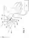 Fig. 04 - DRESSINGS, SYSTEMS AND METHODS FOR PHLEBITIS DETECTION