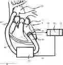 Fig. 01 - Cardiac Device, Method and Computer Program Product