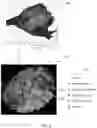 Fig. 06 - SIGNAL AND CORRECTION PROCESSING FOR ANATOMICAL STRUCTURE MAPPING DATA
