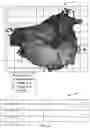Fig. 10 - SIGNAL AND CORRECTION PROCESSING FOR ANATOMICAL STRUCTURE MAPPING DATA