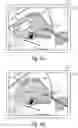 Fig. 06 - Systems and methods for detecting tissue contact by an ultrasound probe