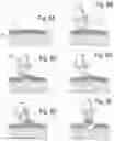 Fig. 07 - FRICTIONAL TISSUE SAMPLING AND COLLECTION METHOD AND DEVICE