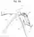 Fig. 21 - ORTHOPEDIC JOINT DISTRACTION DEVICE