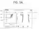 Fig. 25 - ORTHOPEDIC JOINT DISTRACTION DEVICE