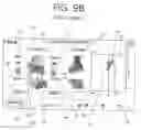 Fig. 26 - ORTHOPEDIC JOINT DISTRACTION DEVICE