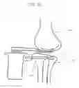 Fig. 39 - ORTHOPEDIC JOINT DISTRACTION DEVICE
