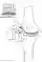 Fig. 01 - Tilting surgical tensor to support at least one bone cut