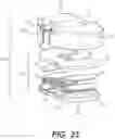 Fig. 15 - Tilting surgical tensor to support at least one bone cut