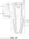 Fig. 20 - Tilting surgical tensor to support at least one bone cut