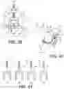 Fig. 26 - Tilting surgical tensor to support at least one bone cut