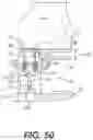 Fig. 31 - Tilting surgical tensor to support at least one bone cut