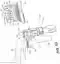 Fig. 34 - Tilting surgical tensor to support at least one bone cut
