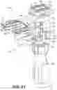 Fig. 42 - Tilting surgical tensor to support at least one bone cut