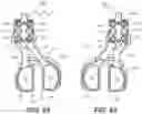 Fig. 46 - Tilting surgical tensor to support at least one bone cut