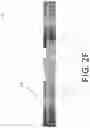 Fig. 07 - Method of planning an arthroplasty procedure