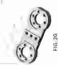 Fig. 08 - Method of planning an arthroplasty procedure