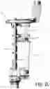 Fig. 13 - Method of planning an arthroplasty procedure