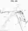 Fig. 21 - Method of planning an arthroplasty procedure