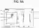 Fig. 25 - Method of planning an arthroplasty procedure