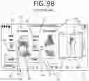 Fig. 26 - Method of planning an arthroplasty procedure