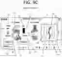 Fig. 27 - Method of planning an arthroplasty procedure
