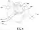Fig. 05 - Surgical retractors and methods of using the same