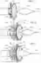 Fig. 04 - Trans-septal closure and port device