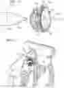 Fig. 05 - Trans-septal closure and port device