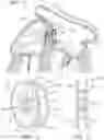 Fig. 06 - Trans-septal closure and port device
