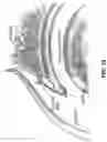 Fig. 19 - METHOD AND APPARATUS FOR ATTACHING TISSUE TO BONE, INCLUDING THE PROVISION AND USE OF A NOVEL KNOTLESS SUTURE ANCHOR SYSTEM