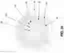 Fig. 23 - METHOD AND APPARATUS FOR ATTACHING TISSUE TO BONE, INCLUDING THE PROVISION AND USE OF A NOVEL KNOTLESS SUTURE ANCHOR SYSTEM