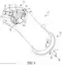 Fig. 02 - Devices, systems, and methods for knotless suture anchors