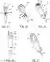 Fig. 13 - Devices, systems, and methods for knotless suture anchors