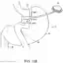 Fig. 73 - Staple cartridge having staple cavities extending at a transverse angle relative to a longitudinal cartridge axis