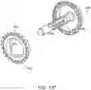 Fig. 80 - Staple cartridge having staple cavities extending at a transverse angle relative to a longitudinal cartridge axis