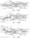 Fig. 160 - Control systems for surgical instruments