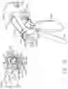 Fig. 37 - Control systems for surgical instruments