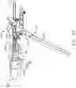 Fig. 62 - Control systems for surgical instruments