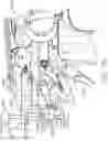 Fig. 71 - Control systems for surgical instruments