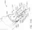 Fig. 99 - Control systems for surgical instruments