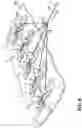 Fig. 06 - Wound closure system